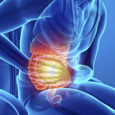 Irritable bowel belly pain